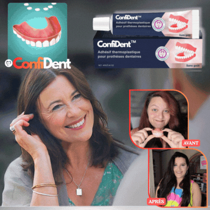 ConfiDent™ Adhésif Dentaire