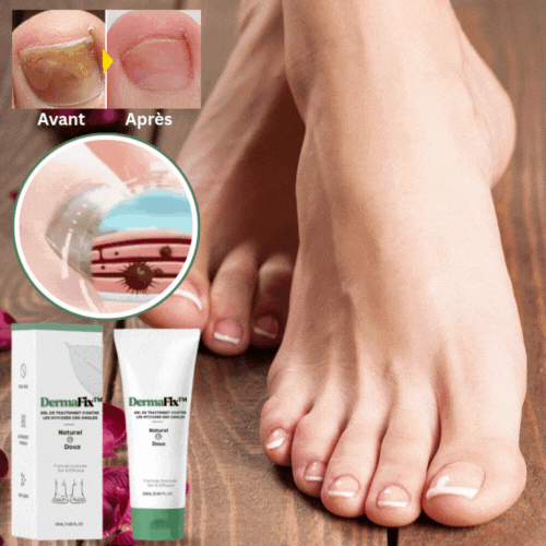 DermaFix™ Gel Antifongiqu